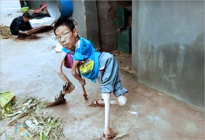 mơ thấy người khuyết tật đánh lô đề con gì