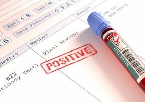 địa chỉ xét nghiệm HIV miễn phí đảm bảo nhất ở Sài Gòn