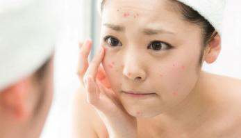Sản phẩm chống dị ứng tốt nhất hiện nay