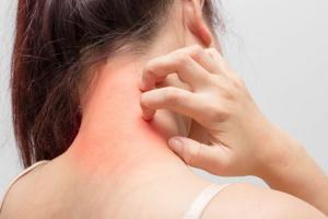 Bí quyết ngăn chặn và phòng ngừa dị ứng bạn nên biết