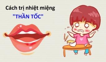 Cách chữa nhiệt miệng hiệu quả nhất hiện nay