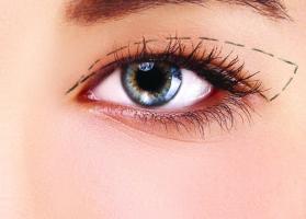 Địa chỉ cắt mí, nhấn mí đẹp và uy tín nhất tỉnh Hải Dương