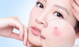 Địa chỉ khám da liễu uy tín nhất tỉnh Lào Cai