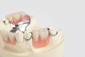Địa chỉ làm răng giả tháo lắp uy tín nhất tại TP. Mỹ Tho, Tiền Giang