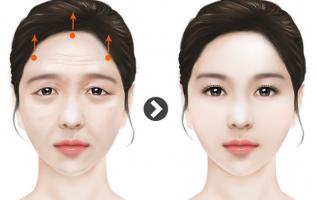 Địa chỉ nâng cung chân mày đẹp, uy tín nhất tỉnh Quảng Ngãi