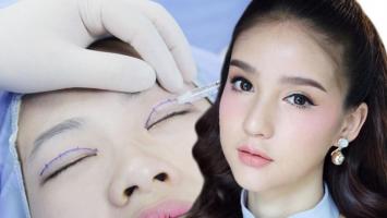 Địa chỉ nhấn mí, cắt mí đẹp, an toàn nhất TP. Nha Trang, Khánh Hòa