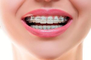 Địa chỉ niềng răng uy tín nhất Quận 6, TP. HCM