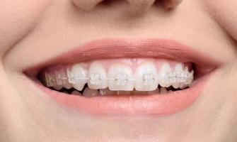 Địa chỉ niềng răng uy tín nhất tỉnh Đắk Nông