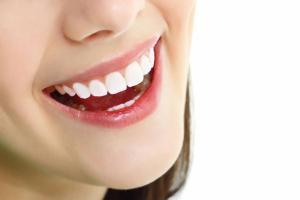 Địa chỉ niềng răng uy tín nhất tỉnh Ninh Thuận