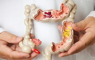 Địa chỉ tầm soát ung thư đại tràng tốt nhất TP. Hồ Chí Minh