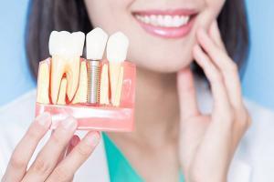 Dịch vụ trồng răng implant tốt nhất tại Hải Phòng