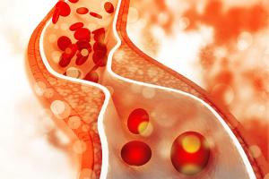 Hướng dẫn khi xét nghiệm kiểm tra cholesterol