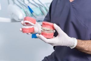 Nha khoa niềng răng uy tín nhất huyện Cần Giờ, TP. HCM