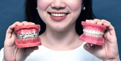 Địa chỉ niềng răng uy tín nhất quận Tân Bình, TP. HCM