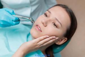 Nha khoa nhổ răng khôn tốt nhất tại Nghệ An