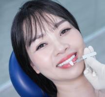Địa chỉ bọc răng sứ uy tín nhất tại Đồng Tháp hiện nay