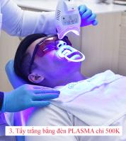 Địa chỉ tẩy trắng răng uy tín nhất Vũng Tàu