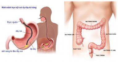 Phòng khám tiêu hóa tốt và uy tín nhất Hà Nội