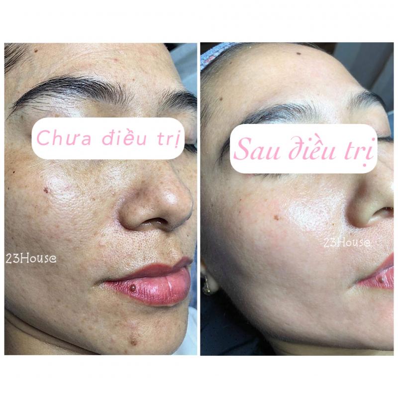 23 HOUSE SPA Dĩ An