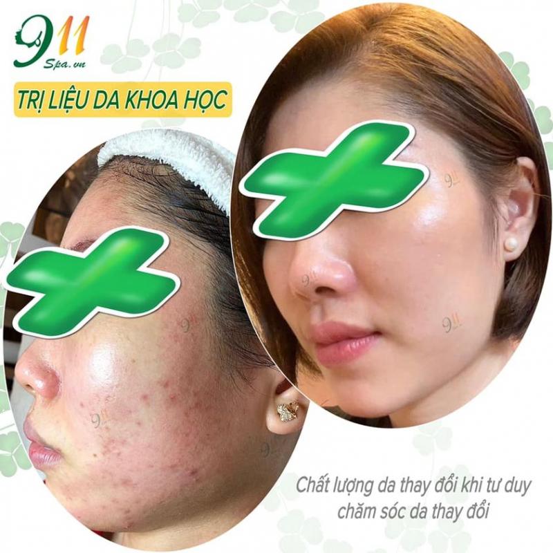 911 Beauty SPA