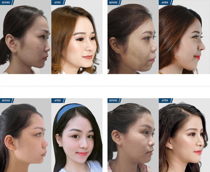 Bệnh viện thẩm mỹ JW