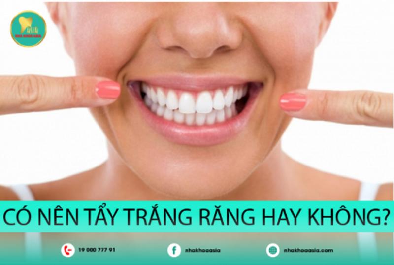Ai không nên tẩy trắng răng?