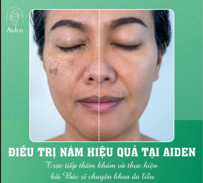 Aiden Beauty Spa & Clinic