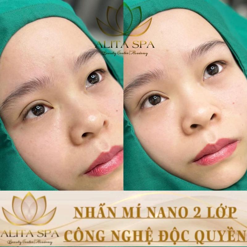 Alita Spa