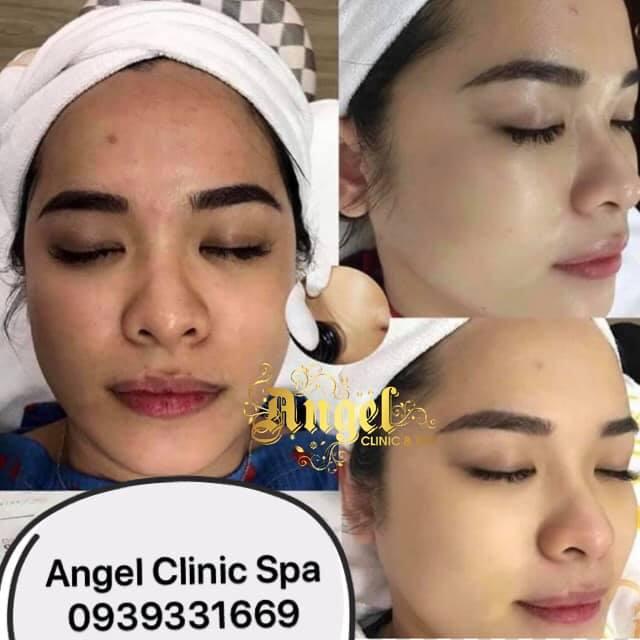 Angel Clinic Spa