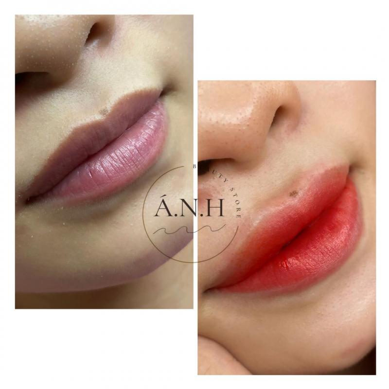 Ánh Beauty