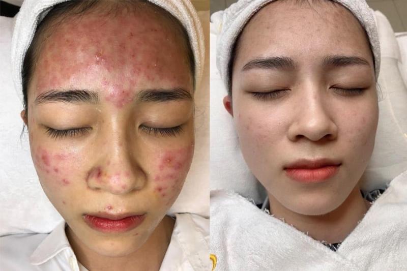 Anna Spa
