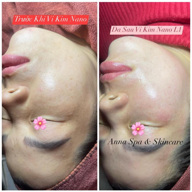 Anna Spa Beautiful