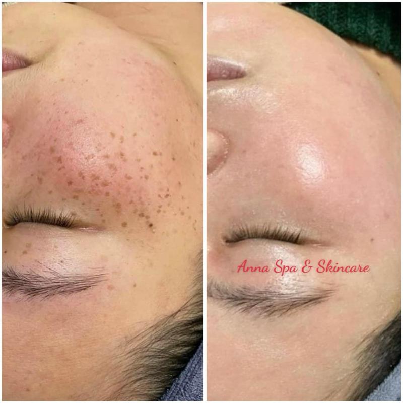 Anna Spa Beautiful