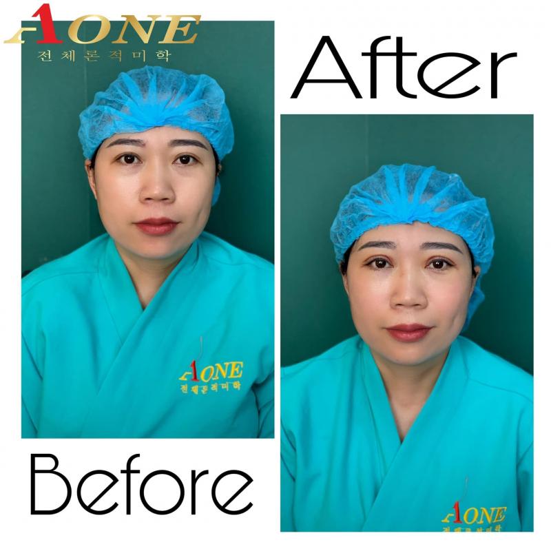 ﻿﻿Aone - Thẩm mỹ uy tín hàng đầu
