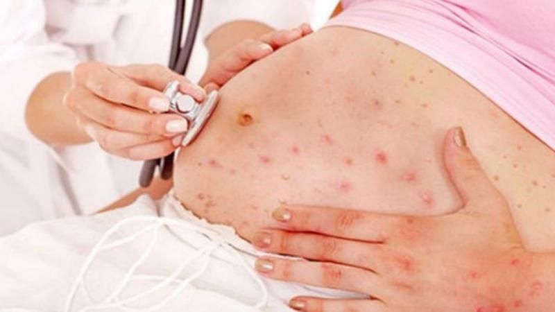 Trên da xuất hiện những mảng đỏ và ngứa