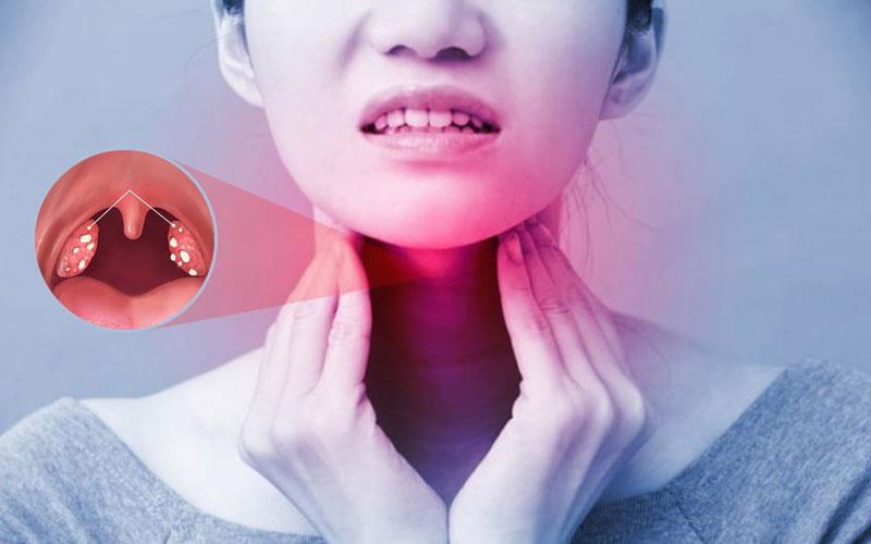 Bác sĩ Chuyên khoa I Đỗ Tấn Vinh chuyên khám amidan