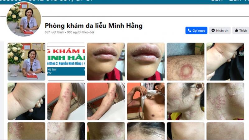 Bác sĩ da liễu Minh Hằng