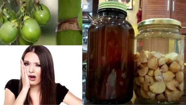 Bài thuốc chữa sâu răng bằng rượu cau