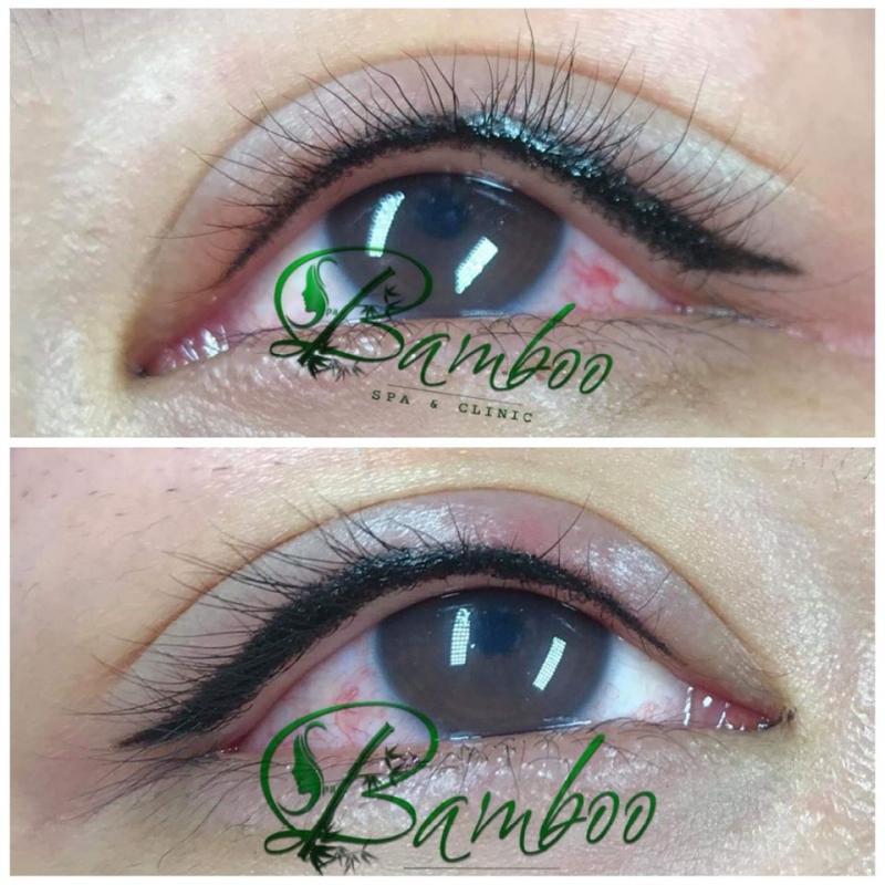 Bamboo Spa & Clinic