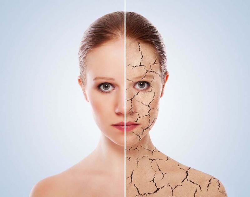 Ăn quá nhiều thịt sẽ dẫn đến hiện tượng mất nước