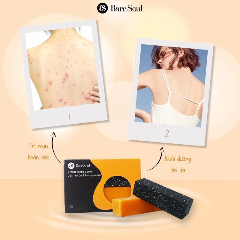Bánh xà phòng BareSoul Herbal Scrub & Soap giảm mụn và thâm cơ thể