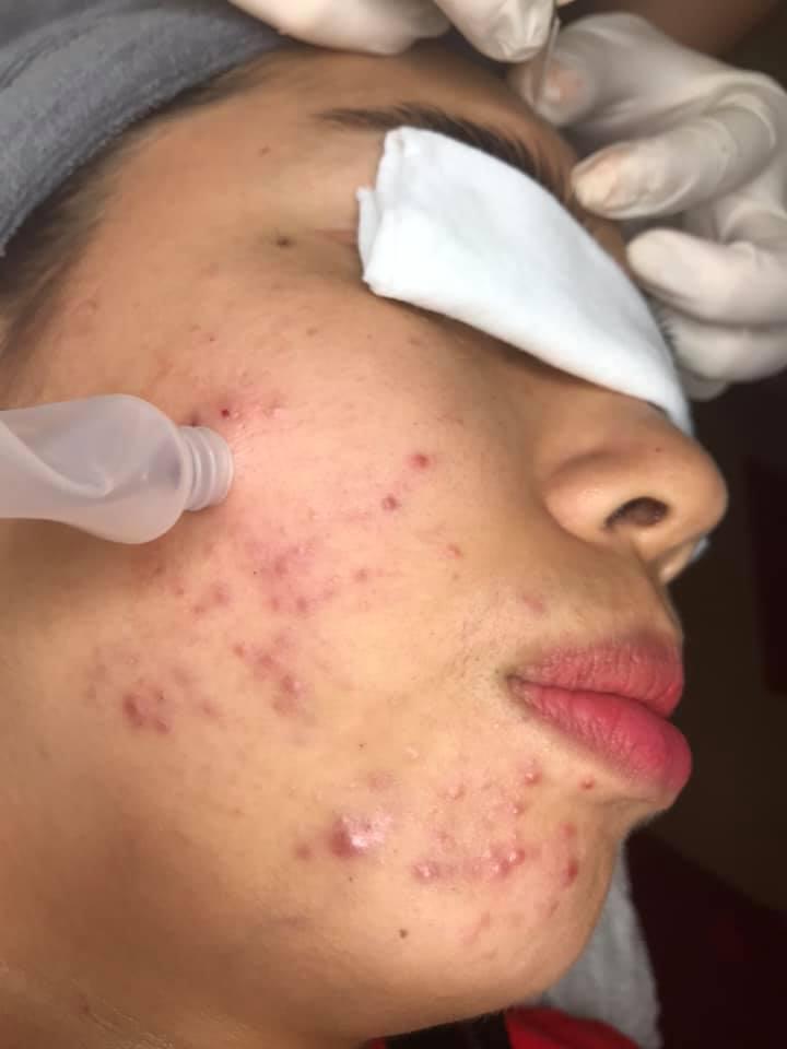 Bela Spa Nha Trang
