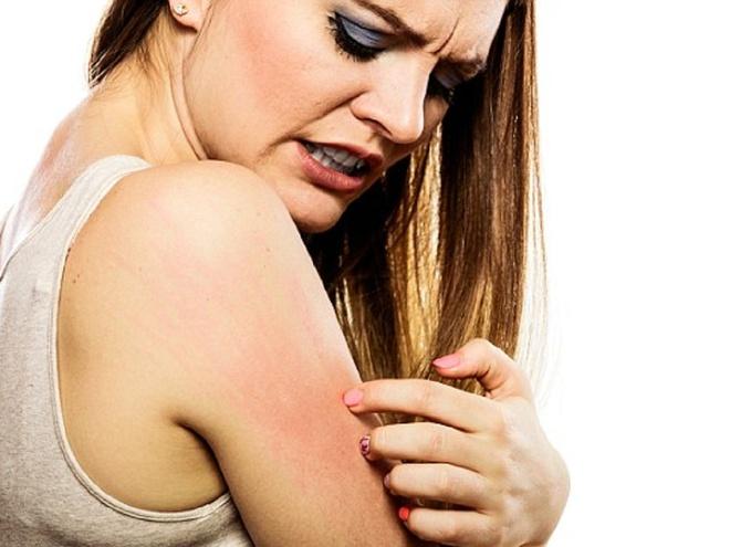 Bệnh da vẽ nổi ảnh hưởng đến cuộc sống
