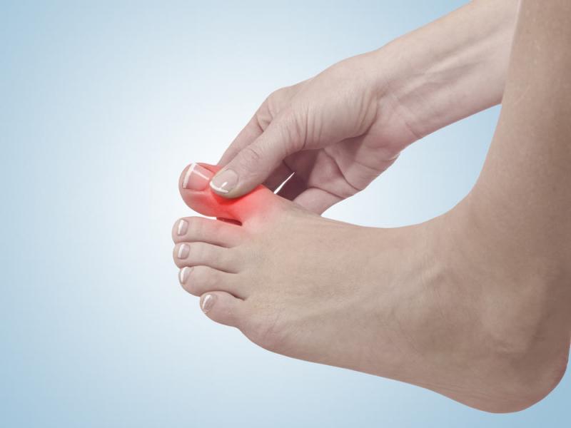 Bệnh gút do nghiện rượu