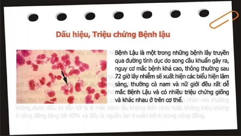 Bệnh lậu