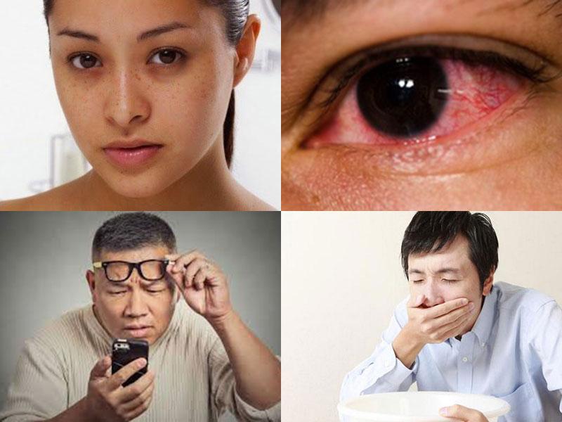 Bệnh tăng nhãn áp có nguy hiểm không?