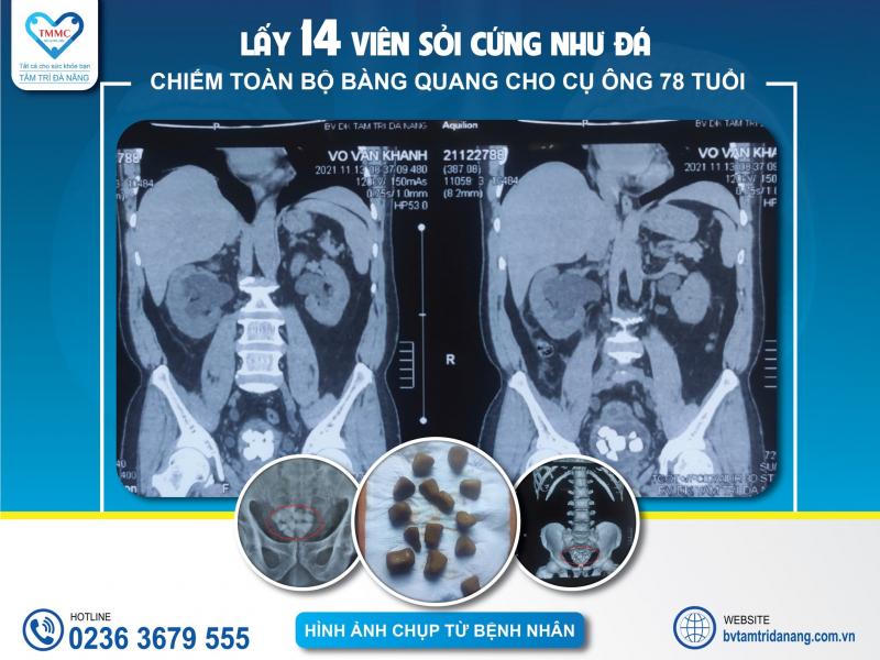 Bệnh Viện Đa Khoa Tâm Trí
