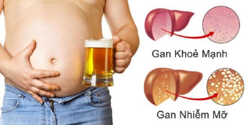 Bệnh viện E