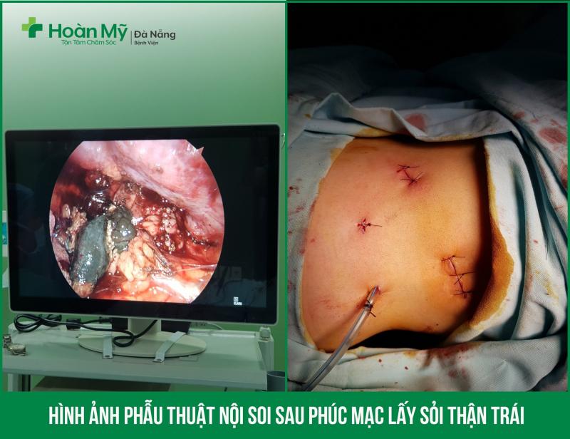 Bệnh viện Hoàn Mỹ Đà Nẵng