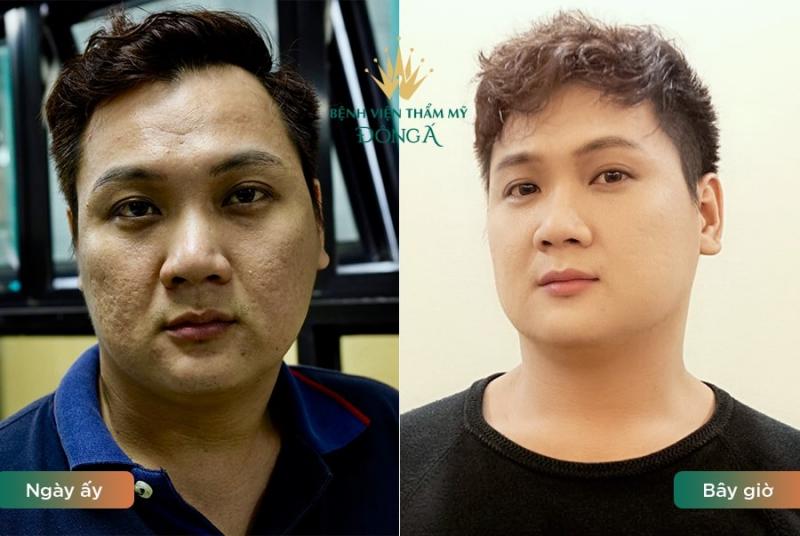 Bệnh viện thẩm mỹ Đông Á